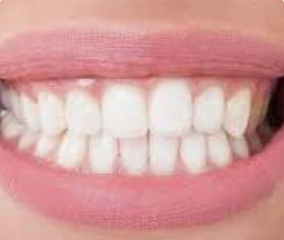 Do not Floss your teeth until you read this!