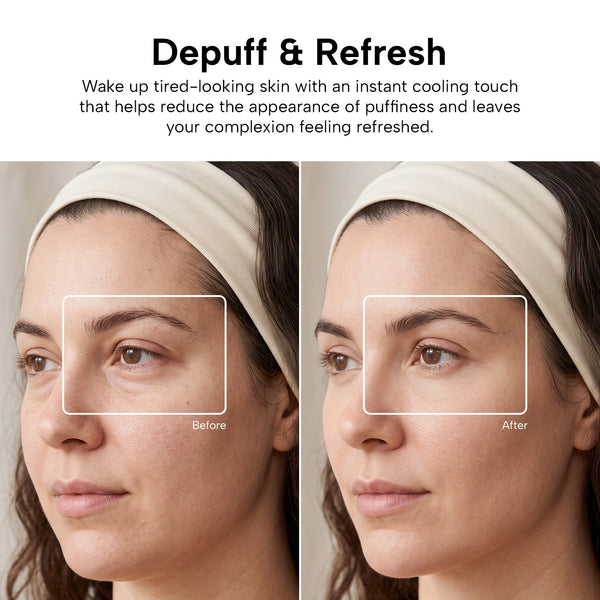 Side-by-side close-ups show a woman with a headband: the Before image highlights under-eye puffiness, while the After image shows visibly reduced puffiness after using the Kleva Range KLEVA® AestheraX Hot & Cold Therapy Massager.