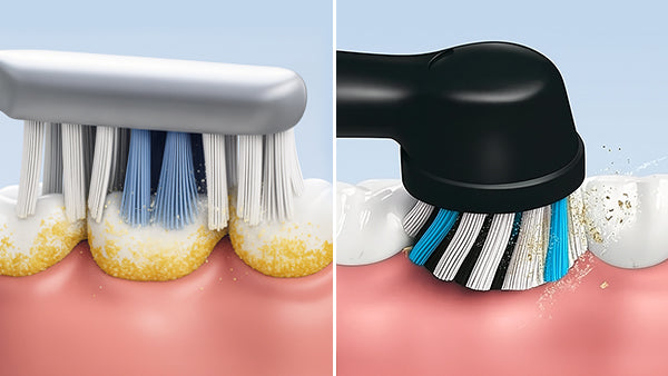 files/Electronic_Tootbbrush_featured_banner_02.jpg